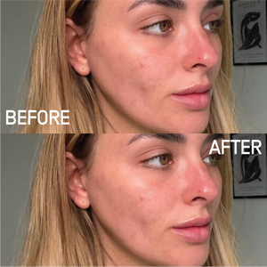 Nocturnal Nourishment Oil - Skin Truth