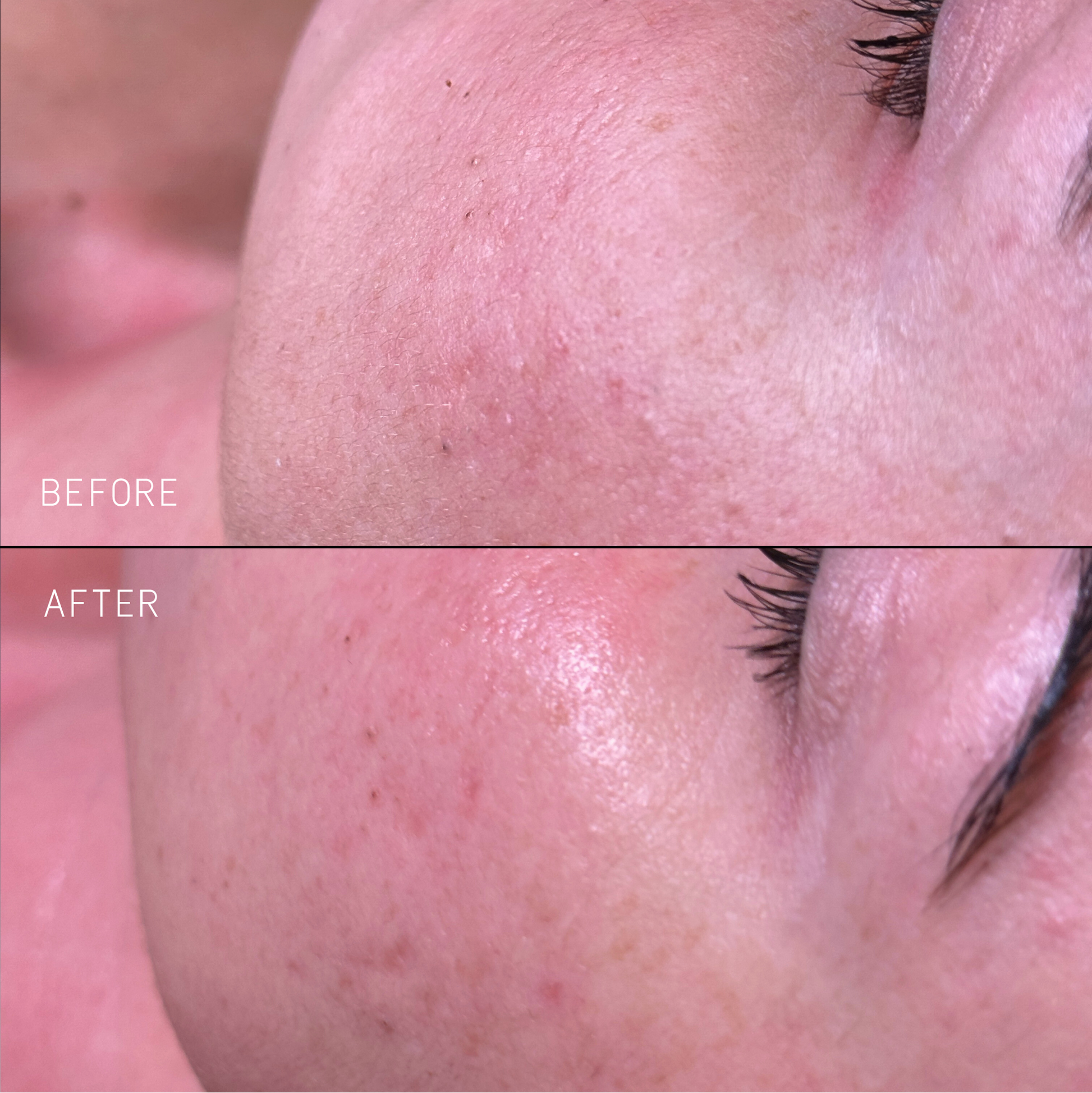 Clarify Kit - Skin Truth