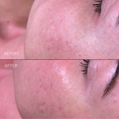 Clarify Kit - Skin Truth