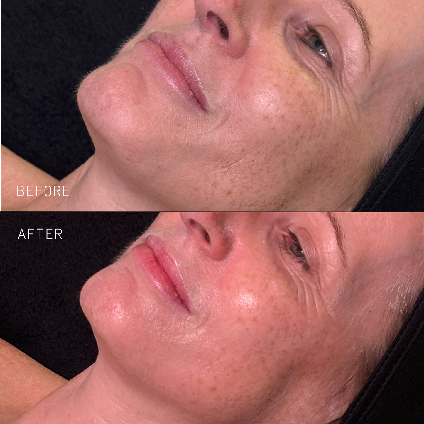 Nourish Kit - Skin Truth