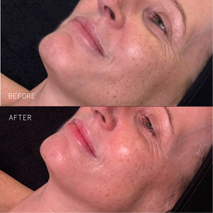 Nourish Kit - Skin Truth